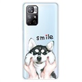 IMD Xiaomi Redmi Note 11 Pro/Note 11 Pro+ TPU-hoesje - Smile